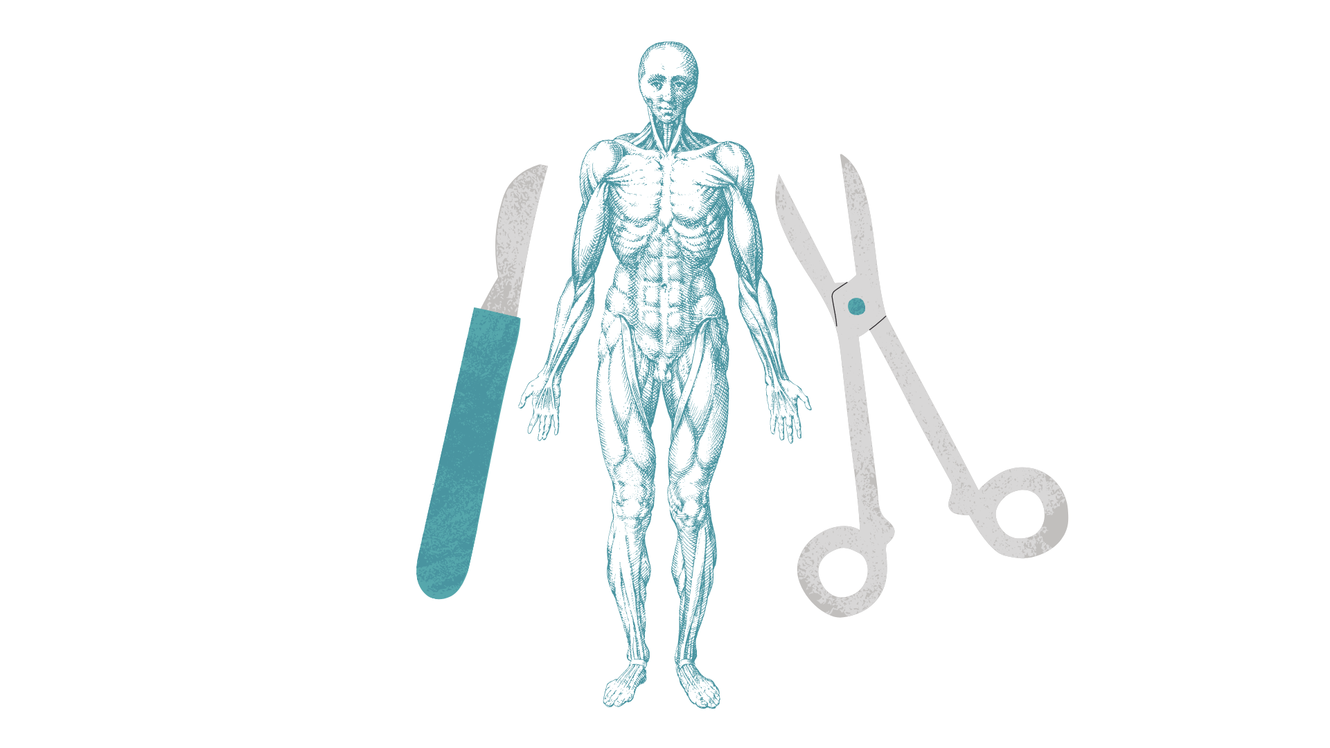 Acute abdomen